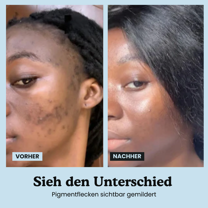 Anti-Pigmentflecken-Kapseln