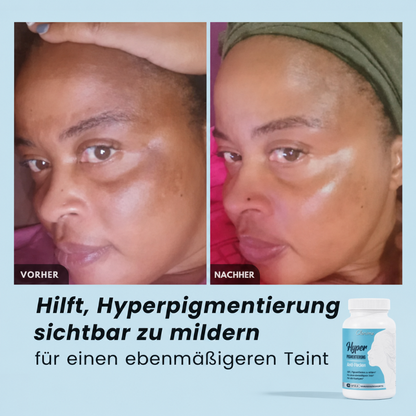 Hyperpigmentierung Anti-Flecken Kapseln