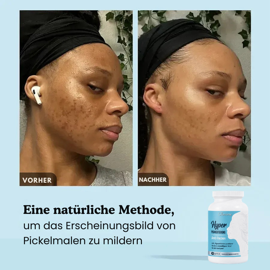 Anti-Pigmentflecken-Kapseln