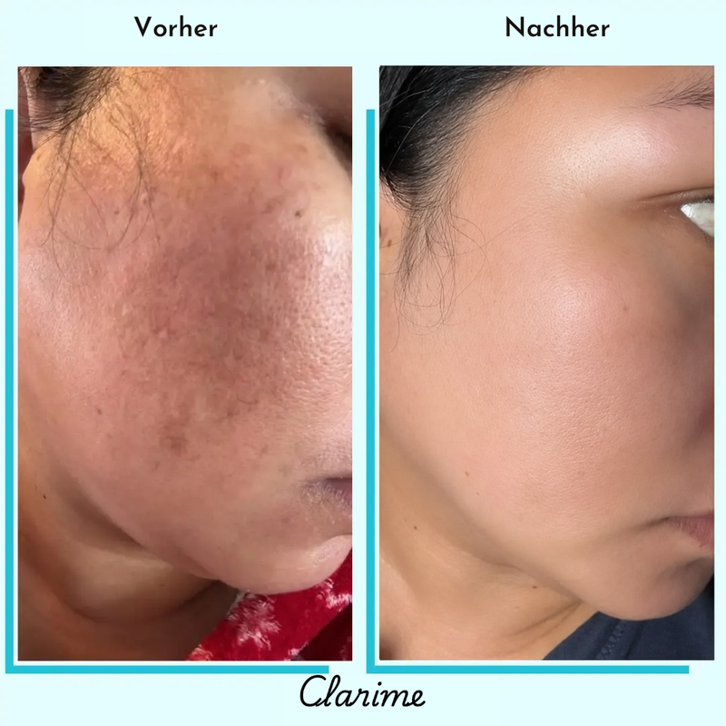 Nadja — before and after