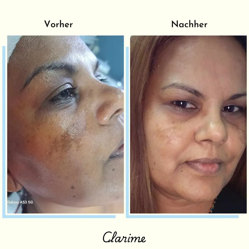 Chantal — before and after