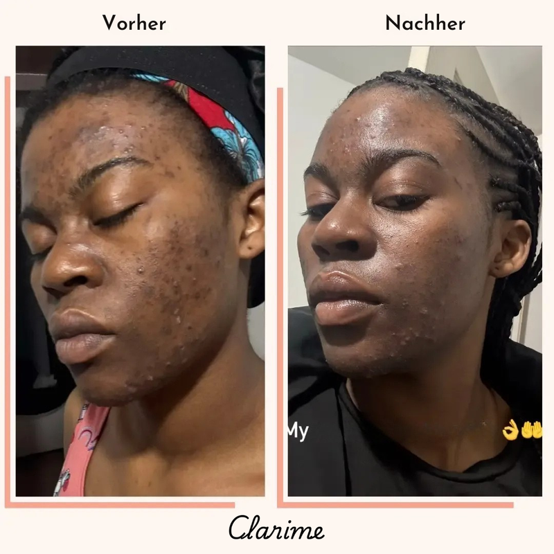 Fatou — before and after