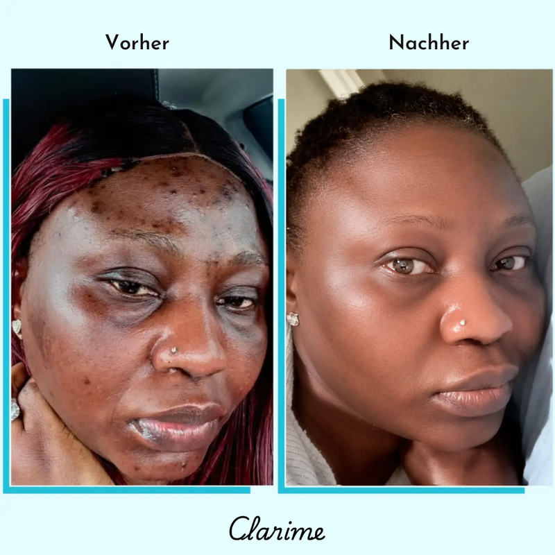 Rokhaya — before and after