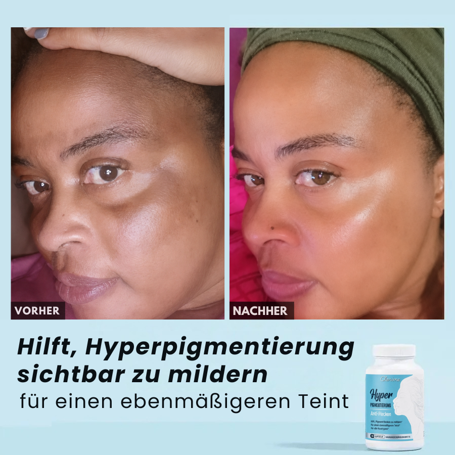Anti-Pigmentflecken-Kapseln
