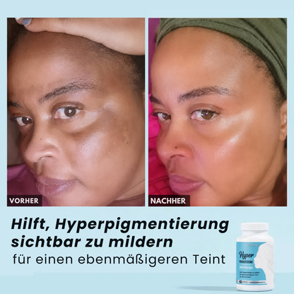 Anti-Pigmentflecken-Kapseln